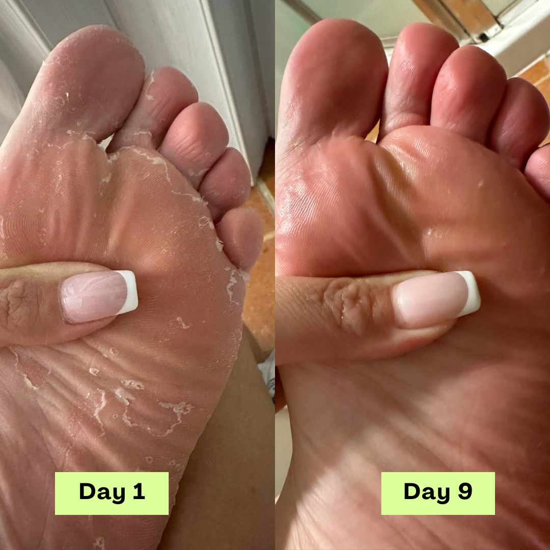 Lumify® AntiFungal Relief Soap Bar