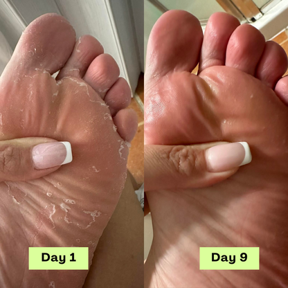 Lumify® AntiFungal Relief Soap Bar